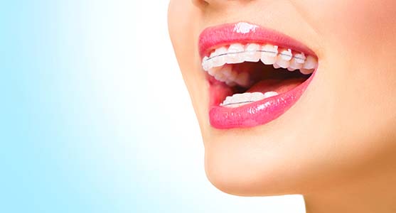 Problems We Can Correct Using Clear Braces In Anaheim