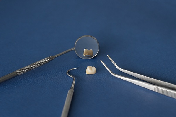 The Complete Guide To Dental Crowns: Types, Costs &#   ; Care