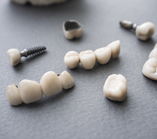 Anaheim The Difference Between Dental Implants and Mini Dental Implants