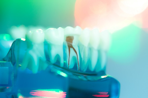 Root Canal Symptoms: How Painful Is An Infected Tooth?